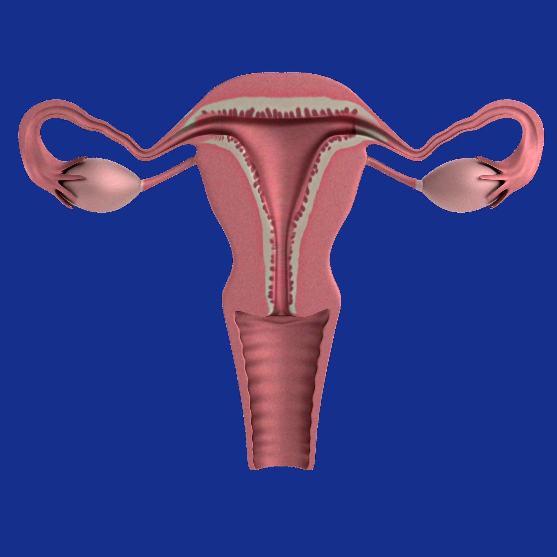 cervical cancer