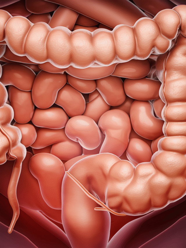 These symptoms of colon cancer can be fatal.